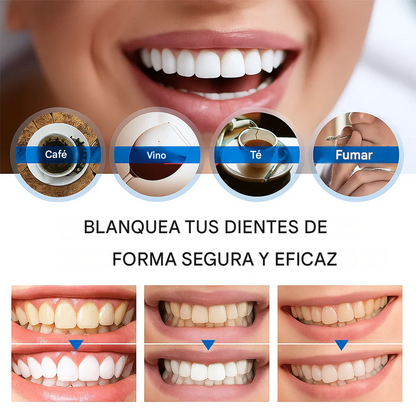 Lápiz blanqueador dental Instant Bright – Suave y sin sensibilidad