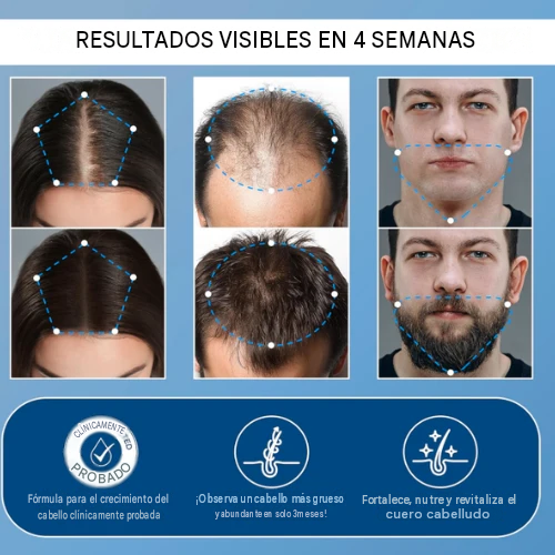 Sérum en roll-on para el crecimiento del cabello de Aparthy