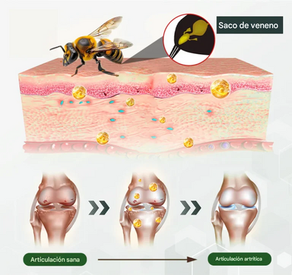 Adfire® Espray revitalizante para huesos y articulaciones con veneno de abeja