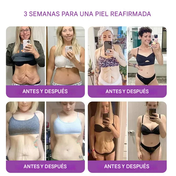 Crema restauradora de la piel con péptido de néctar de reina + bakuchiol YUNPSO™