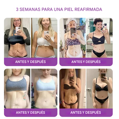 Crema restauradora de la piel con péptido de néctar de reina + bakuchiol YUNPSO™