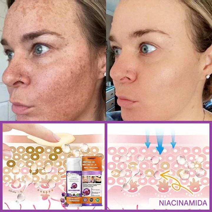 Crema restauradora de la piel con péptido de néctar de reina + bakuchiol YUNPSO™