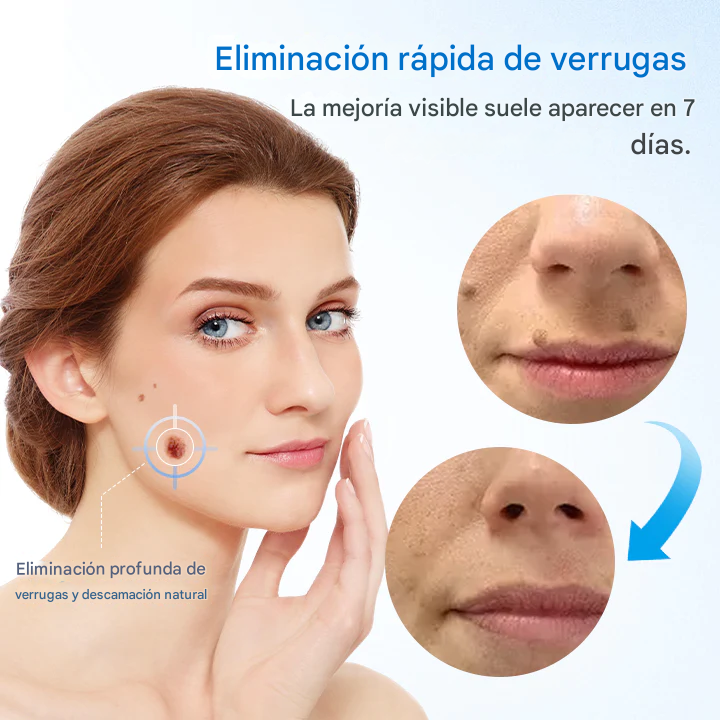 Crema para eliminar verrugas Timilk® TagGone