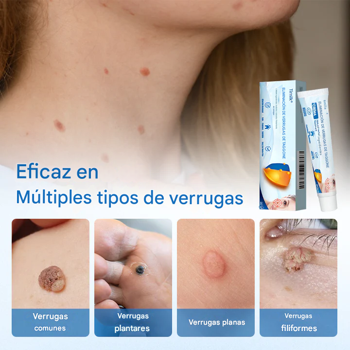 Crema para eliminar verrugas Timilk® TagGone