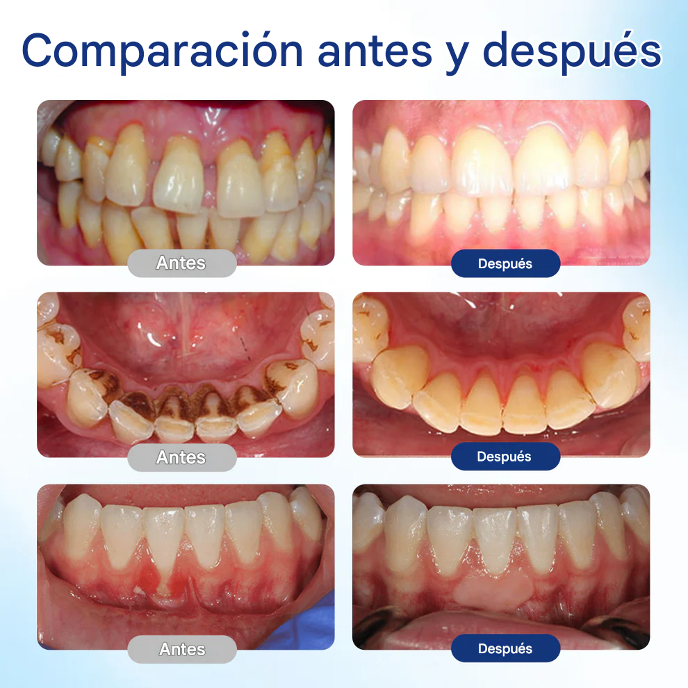 Solución reparadora bucal Biancat® BeeTakt