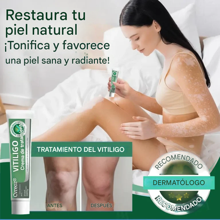 Crema para el tratamiento del vitíligo Cvreoz®