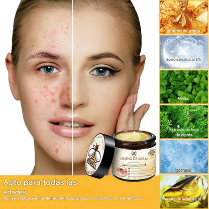 🐝✨𝑩𝑺𝑾𝑬𝑳𝑳® Crema de Veneno de Abeja 👨‍⚕️ (Recomendada por dermatólogos) (70% de descuento)