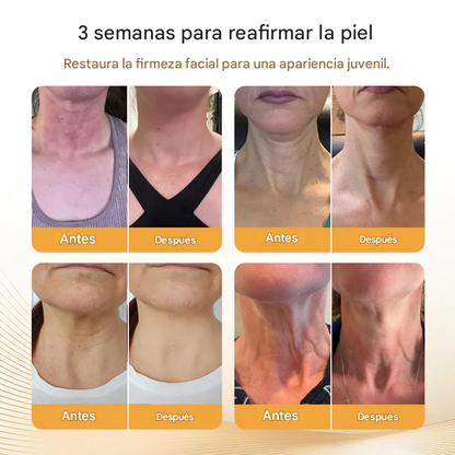 Biancat® Barra reafirmante para el cuello