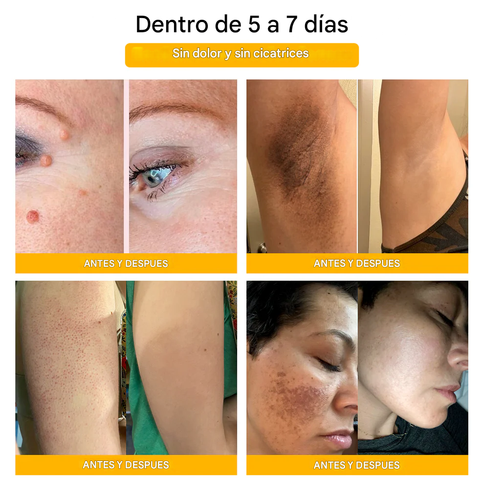 🐝✨𝑩𝑺𝑾𝑬𝑳𝑳® Crema de Veneno de Abeja 👨‍⚕️ (Recomendada por dermatólogos) (70% de descuento)