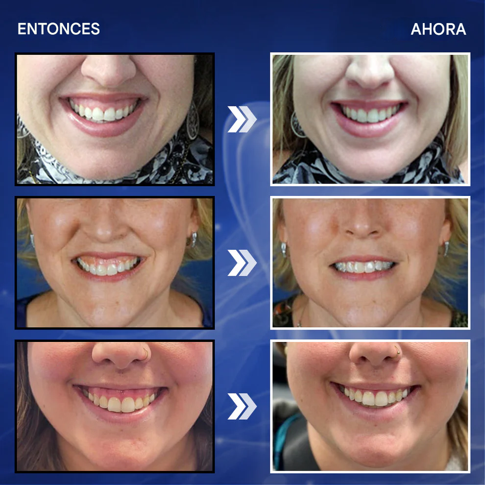 Enjuague bucal con gotas para el tratamiento dental - BeeTakt Bee Venom