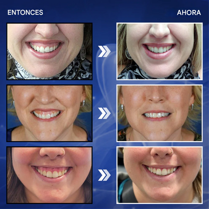 Enjuague bucal con gotas para el tratamiento dental - BeeTakt Bee Venom