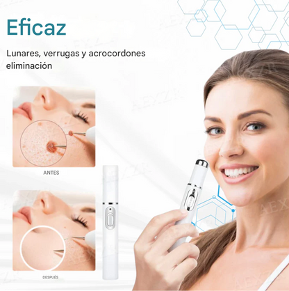 Bikenda® Láser Portátil – Elimina Verrugas,Lunares y Manchas de Forma Rápida y Sin Dolor