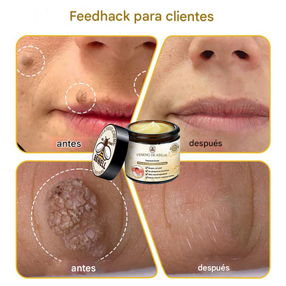 🐝✨𝑩𝑺𝑾𝑬𝑳𝑳® Crema de Veneno de Abeja 👨‍⚕️ (Recomendada por dermatólogos) (70% de descuento)