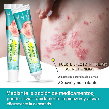 Crema Para La Psoriasis Y El Eczema, Crema Antipicazón A