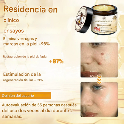 🐝✨𝑩𝑺𝑾𝑬𝑳𝑳® Crema de Veneno de Abeja 👨‍⚕️ (Recomendada por dermatólogos) (70% de descuento)