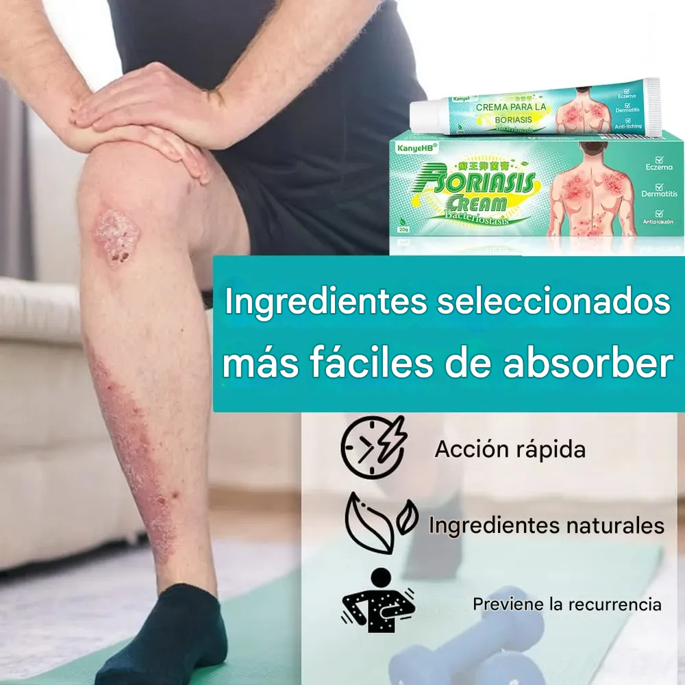 Crema Para La Psoriasis Y El Eczema, Crema Antipicazón A