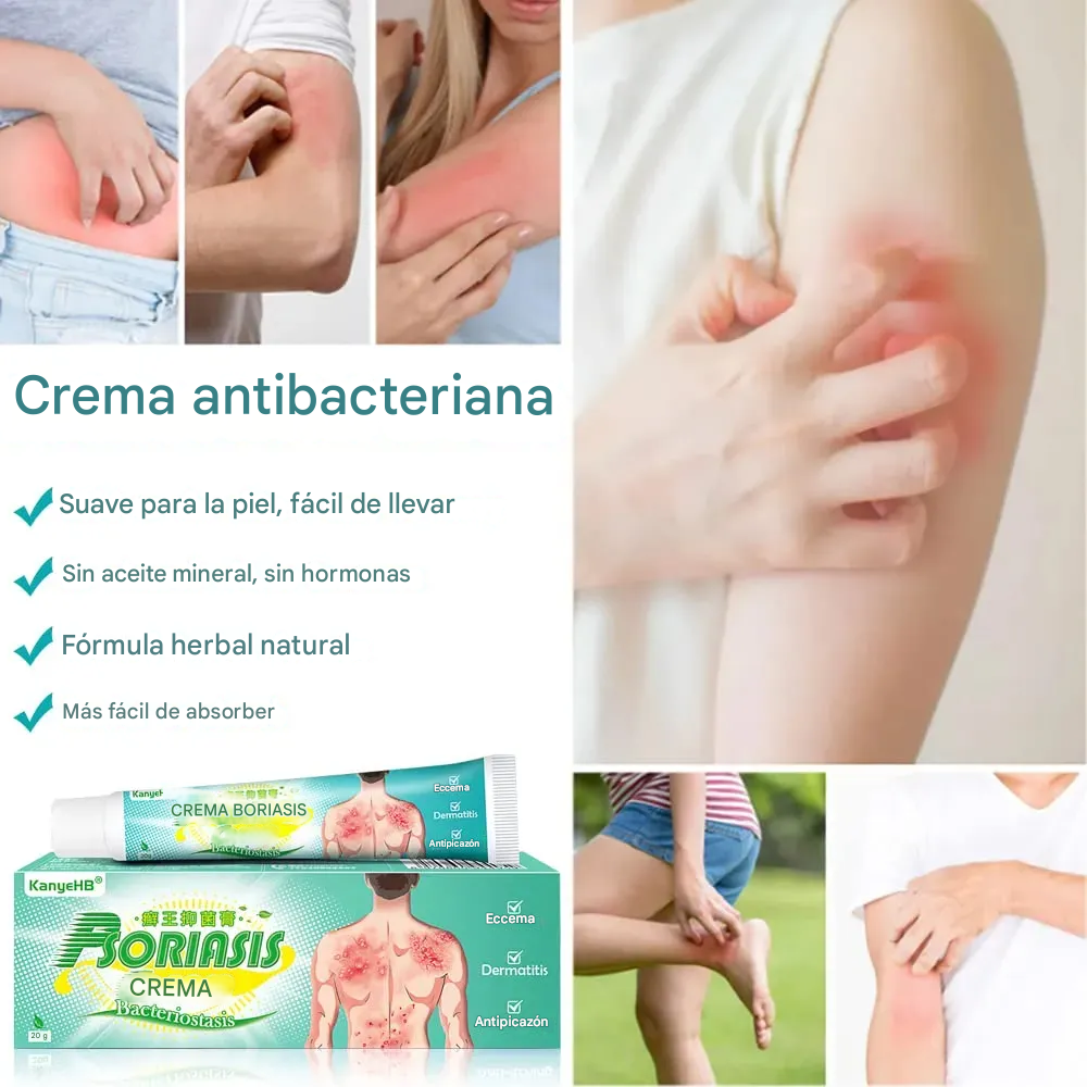 Crema Para La Psoriasis Y El Eczema, Crema Antipicazón A