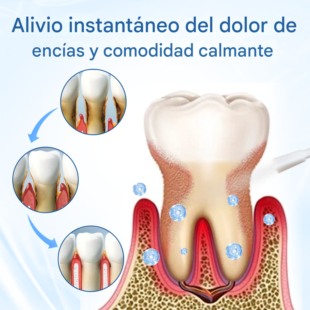 Spray Natural Para Alivio De Las Encias