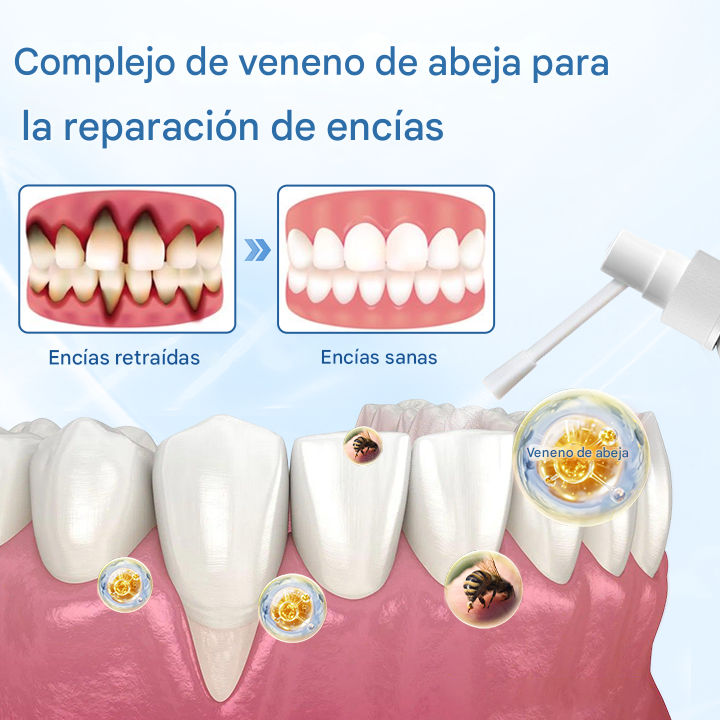 Spray Natural Para Alivio De Las Encias