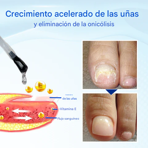 Biancat® OnyxoGuard Suero para el crecimiento y la reparación de uñas