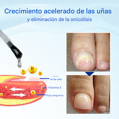 Biancat® OnyxoGuard Suero para el crecimiento y la reparación de uñas
