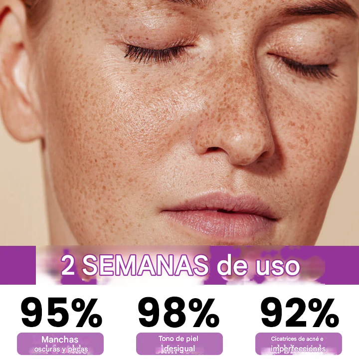 Ceoerty® MelantraX Esencia antihiperpigmentación avanzada