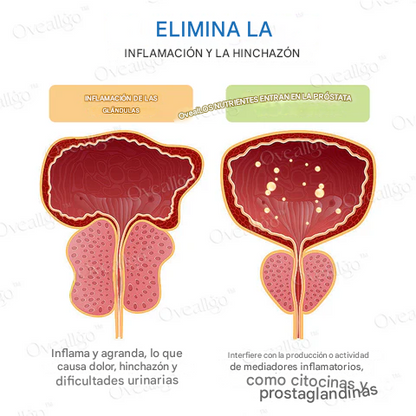 Oveallgo™ ProstaAce PT-141 Espray nasal