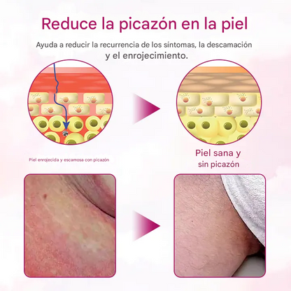 Crema de alivio suave para mujeres Timilk®