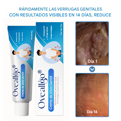Crema para el alivio de las verrugas genitales por VPH Oveallgo®