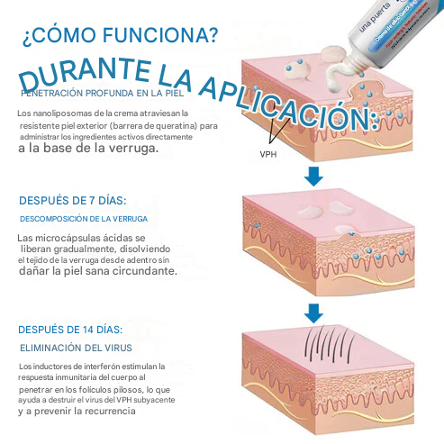 Crema para el alivio de las verrugas genitales por VPH Oveallgo®