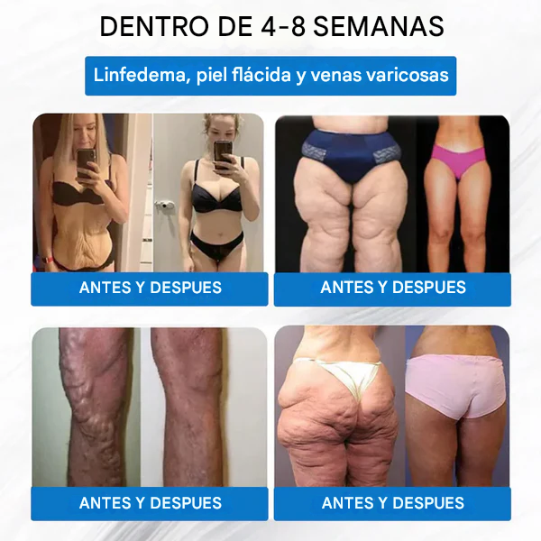 [Ver resultados en 7 días] Parche de nano microagujas WarmFamily® SMGT-GLP-1 (indoloro, de larga duración, trata la diabetes, la obesidad y las enfermedades cardiovasculares)