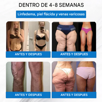 [Ver resultados en 7 días] Parche de nano microagujas WarmFamily® SMGT-GLP-1 (indoloro, de larga duración, trata la diabetes, la obesidad y las enfermedades cardiovasculares)