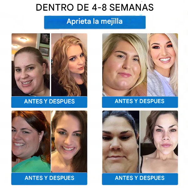 [Ver resultados en 7 días] Parche de nano microagujas WarmFamily® SMGT-GLP-1 (indoloro, de larga duración, trata la diabetes, la obesidad y las enfermedades cardiovasculares)