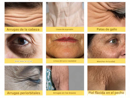 Crema reparadora rápida de 7 días para todas las enfermedades de la piel.