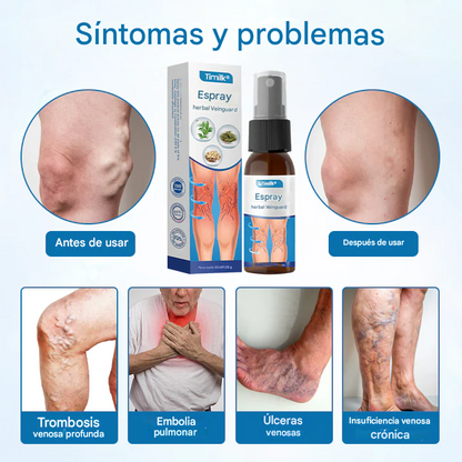 PROMO 2X1 - Timilk®  - Spray Para Venas Varices