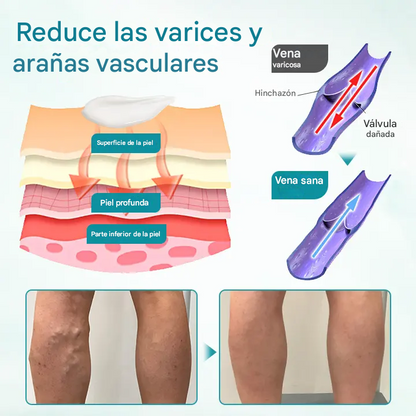 Crema para el alivio de las venas Timilk® VeinAway