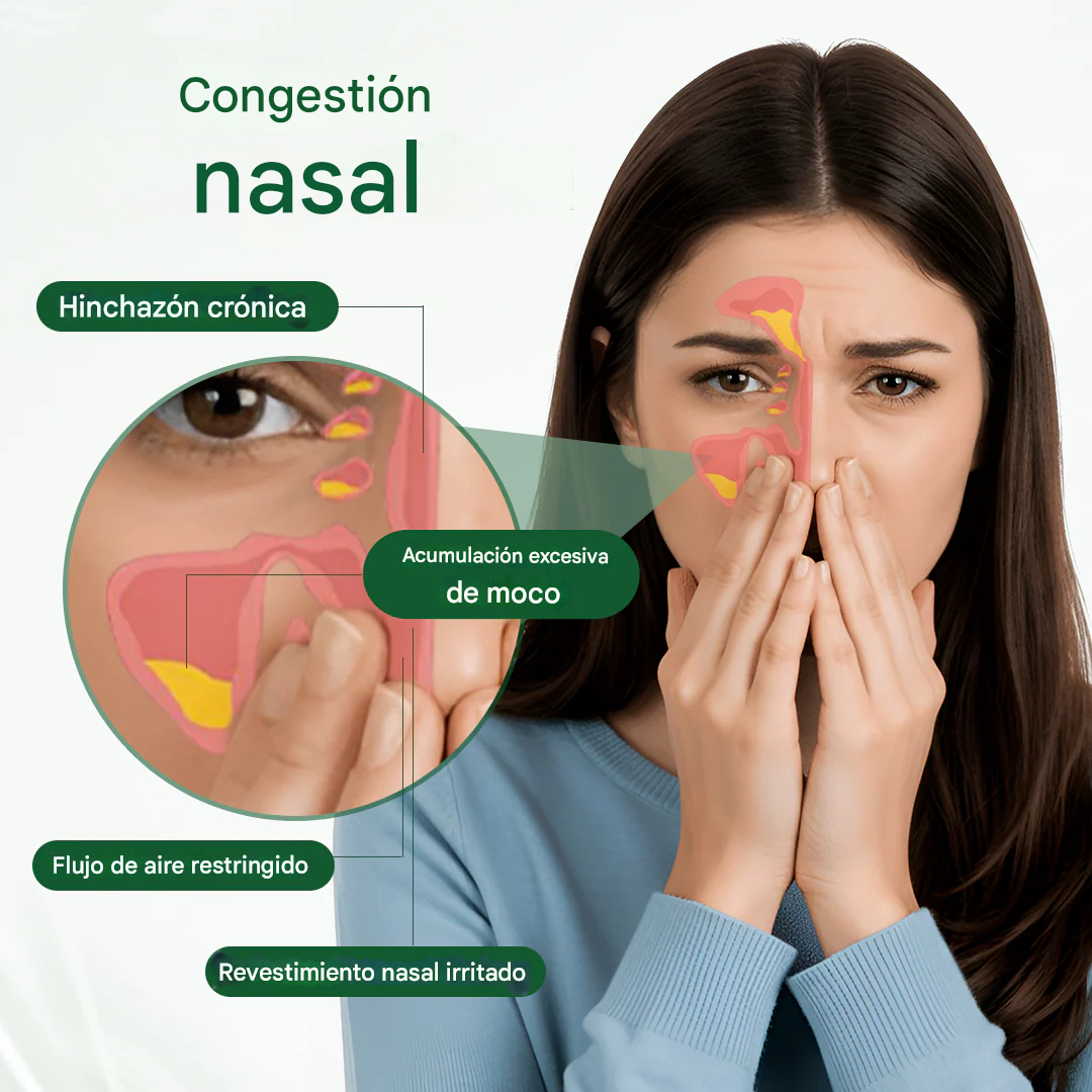 Healrize® BioActive Herbal Sinus Mist - Spray para aliviar la sinusitis y la fiebre del heno