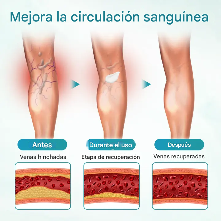 Crema para el alivio de las venas Timilk® VeinAway