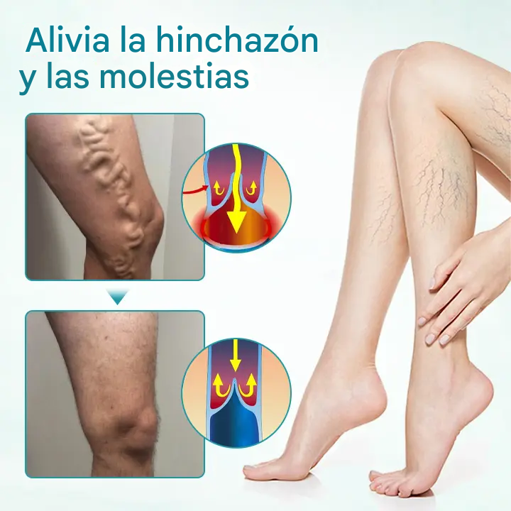 Crema para el alivio de las venas Timilk® VeinAway