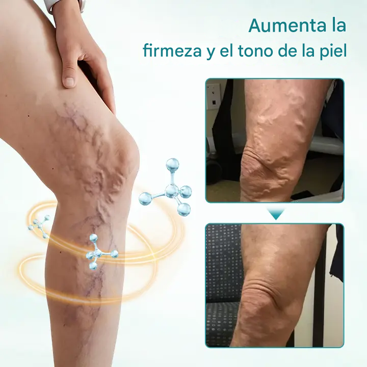 Crema para el alivio de las venas Timilk® VeinAway