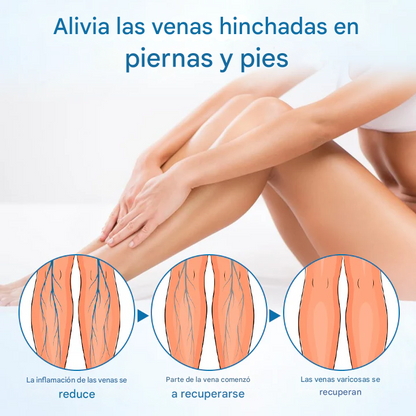 PROMO 2X1 - Timilk®  - Spray Para Venas Varices