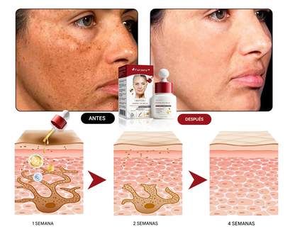 Suero antiarrugas Furzero™ Botox con veneno de abeja