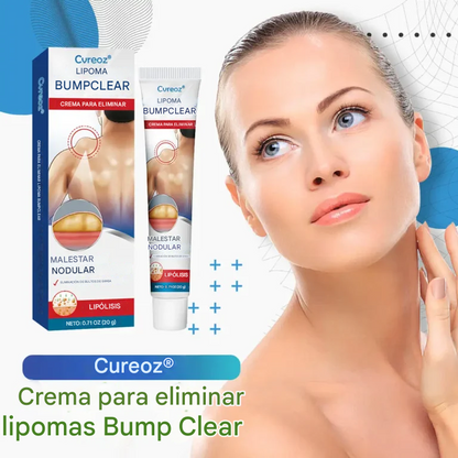Crema para la eliminación de lipomas Cvreoz® BumpClear