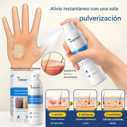 Kubozn® Magnesium Herbal Psoriasis Spray Alivia la psoriasis y el eczema