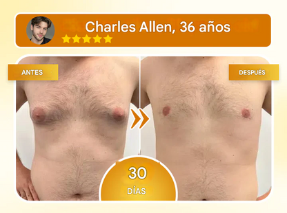 Aceite esculpidor de pecho Biancat® Redefine tu pecho, recupera tu confianza
