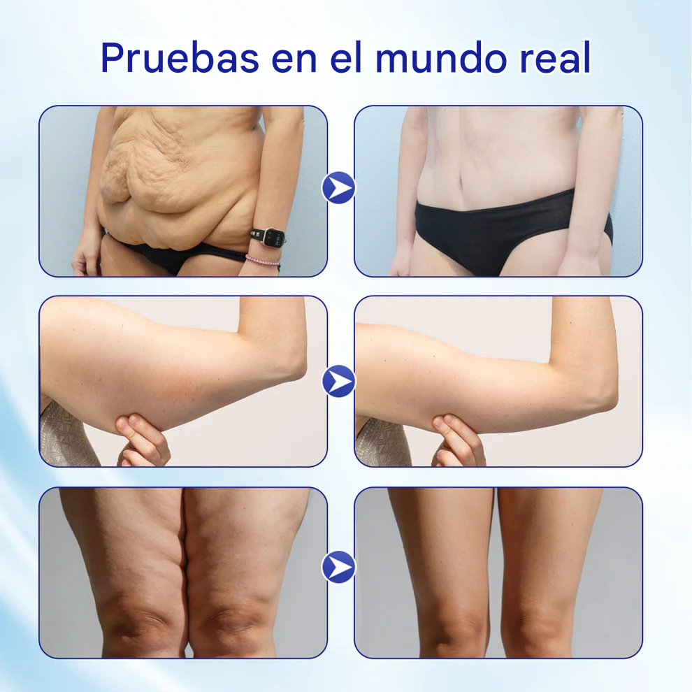 24K Golden FatBurn Nano Essence - Quemador de grasa