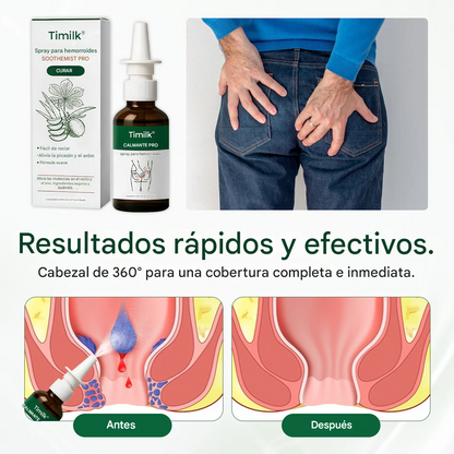 Timilk® SootheMist PRO Spray para hemorroides