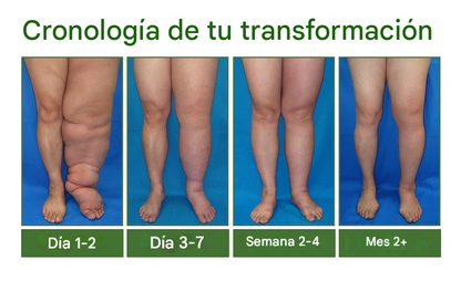 VenoLift Timilk® Spray Para Alivio pesadas e hinchases