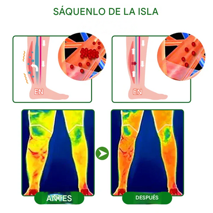 VenoLift Timilk® Spray Para Alivio pesadas e hinchases