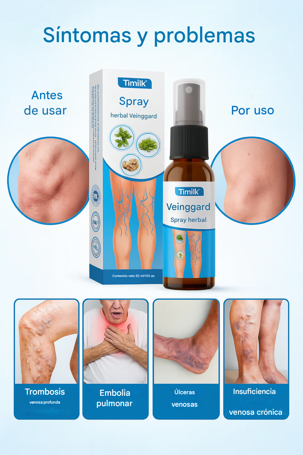 Timilk® VeinGuard, 99.9% Eliminando las varices desde casa + 🎁